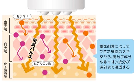 エレクトロポレーションの電気パルス効果