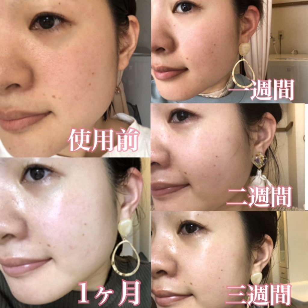 28歳 くすみ肌 ノーファンデ計画はじめました 奈良 京都 大阪の美容室 ハピネス 28歳 くすみ肌 ノーファンデ計画はじめました 奈良 京都 大阪の美容室 ハピネス