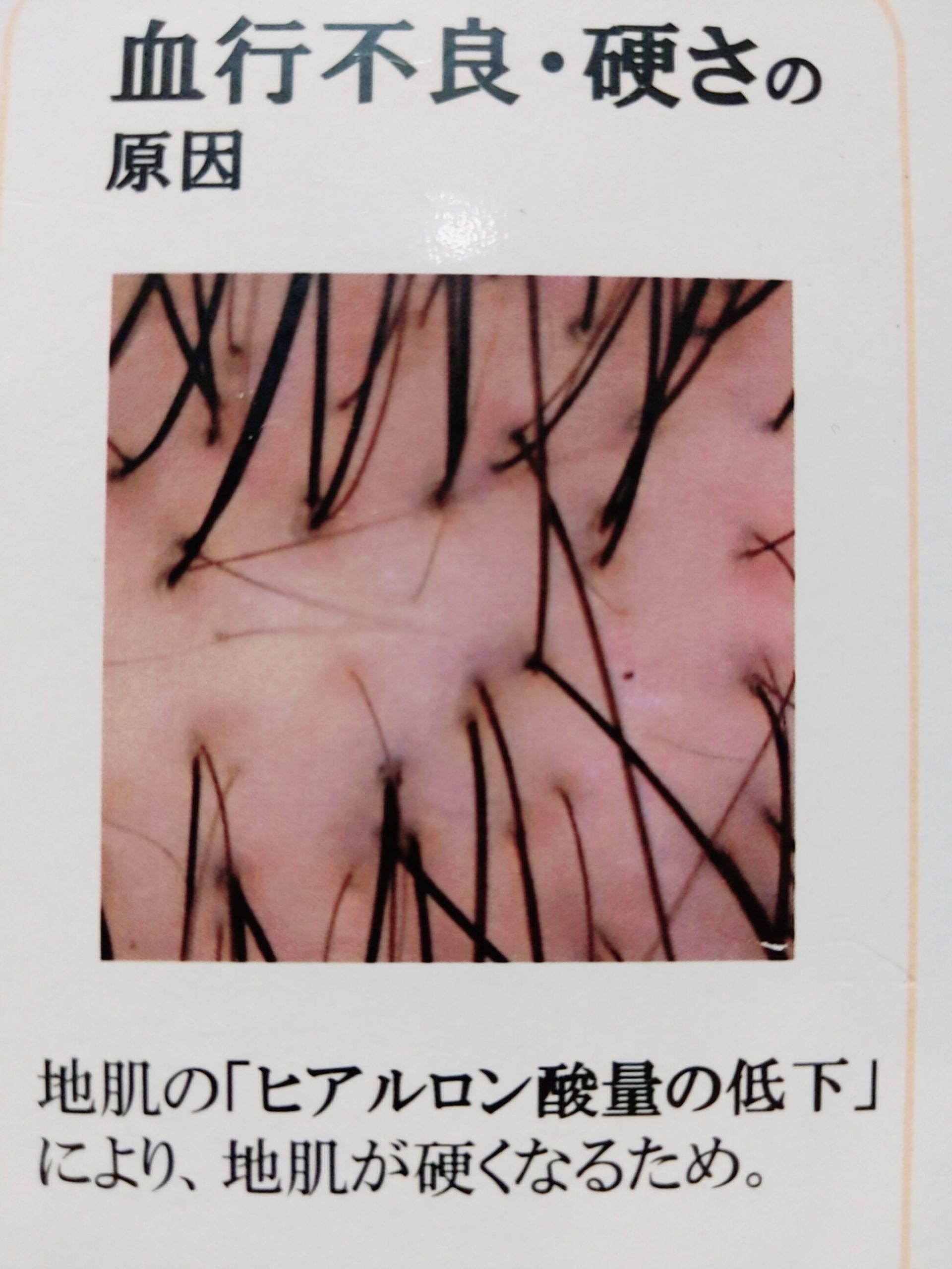 エイジング毛とは 30代 40代から出てくるエイジング毛の改善方法part2 奈良 京都 大阪の美容室 ハピネス