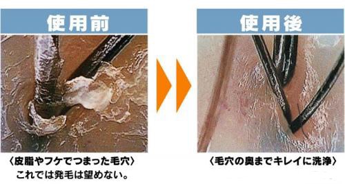 頭皮の臭いや薄毛の原因って 癒しだけじゃない 臭いや薄毛も予防できるヘッドスパとは 奈良 京都 大阪の美容室 ハピネス 頭皮の臭いや薄毛の原因って 癒しだけじゃない 臭いや薄毛も予防できるヘッドスパとは 奈良 京都 大阪の美容室 ハピネス