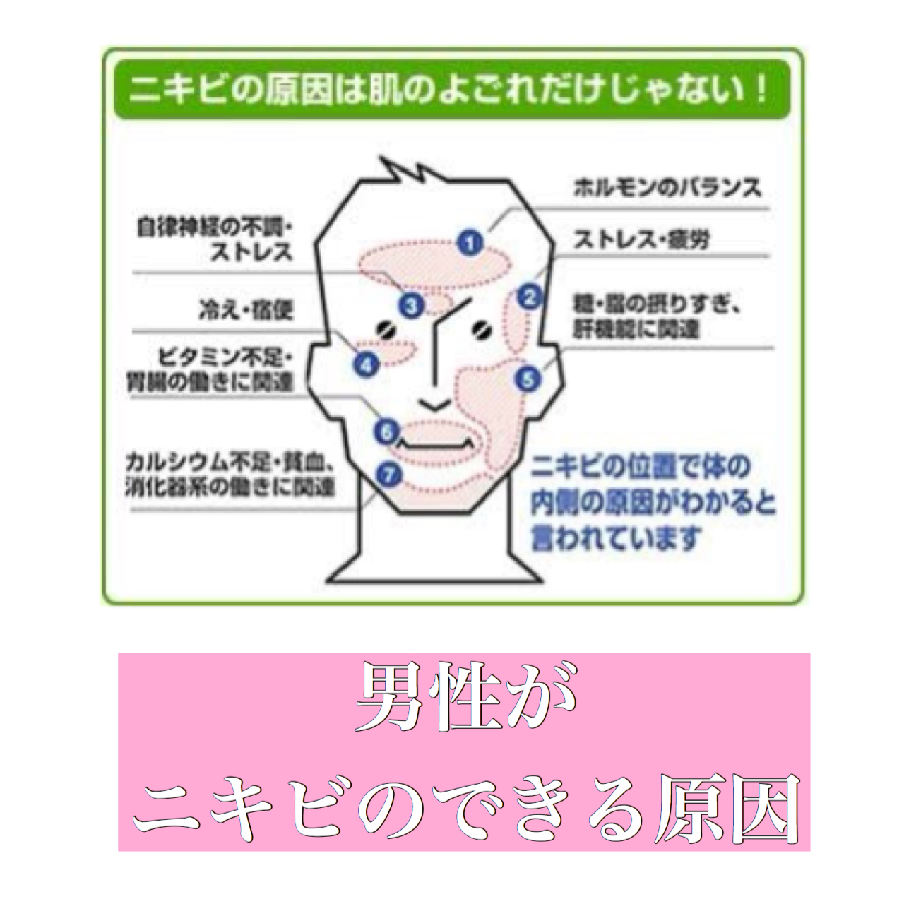 位置 占い ニキビ 両思いニキビとは？位置は鼻って本当？恋愛ニキビ占い11個