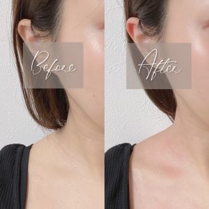 5分で効果を実感!全身使えるハイスペック美顔器【ビューティー